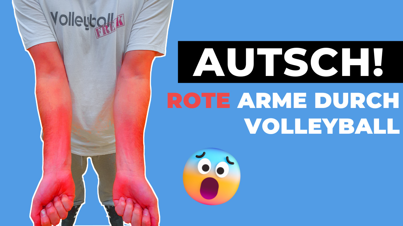 Rote Arme nach dem Volleyball spielen?!